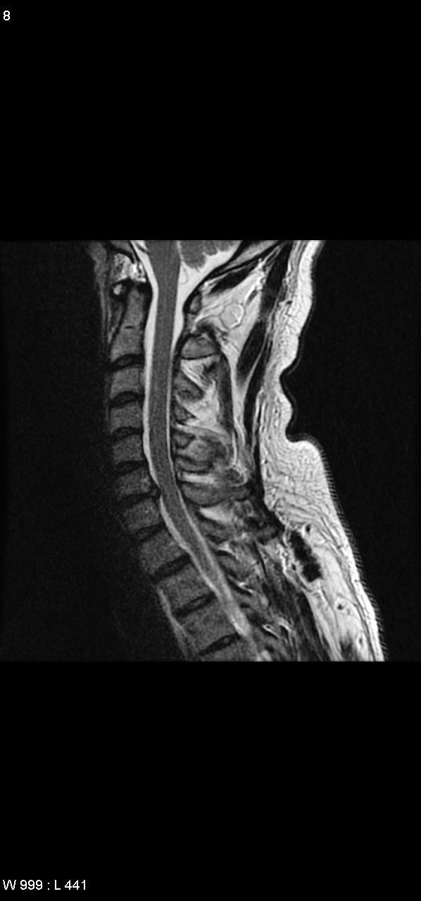x-ray