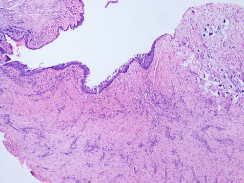 Figure_2_Histopathology (1)