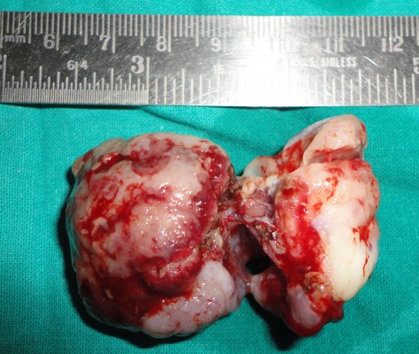 Figure_4