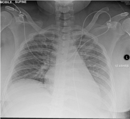 Case_Study_Figure_1