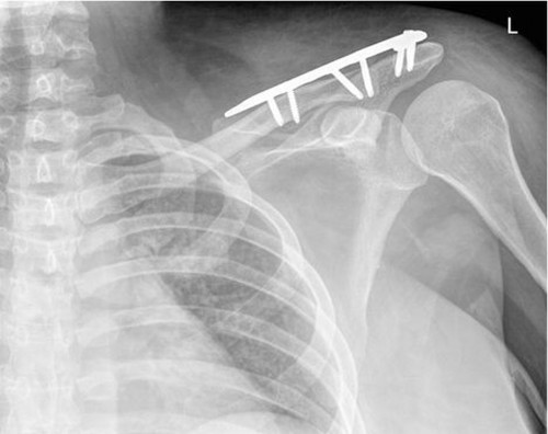 Case_Study_Figure_2