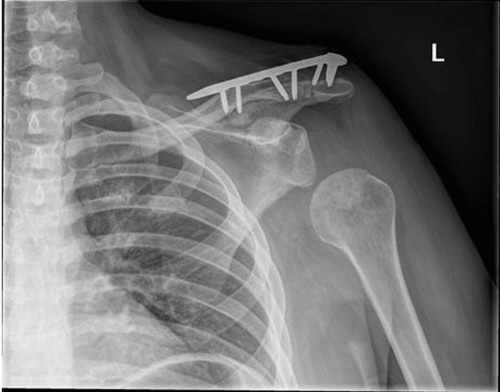 Case_Study_Figure_3