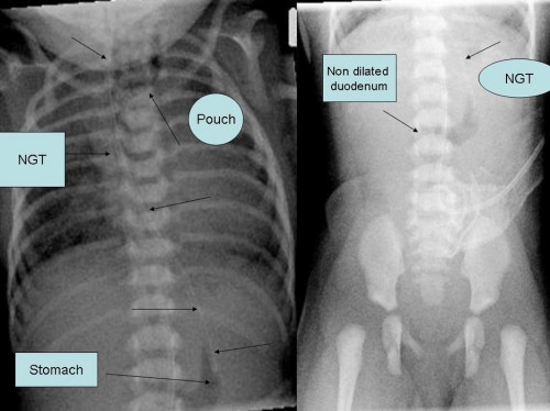 Fig_1_Radiographs