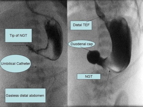 Fig_2_Contrast_radiographs