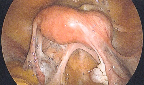 Figure_1 (20)