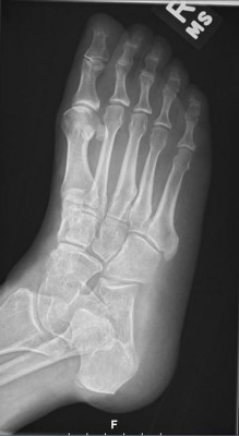 Figure_1B