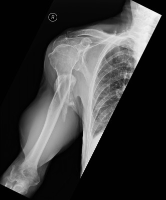 Figure_2