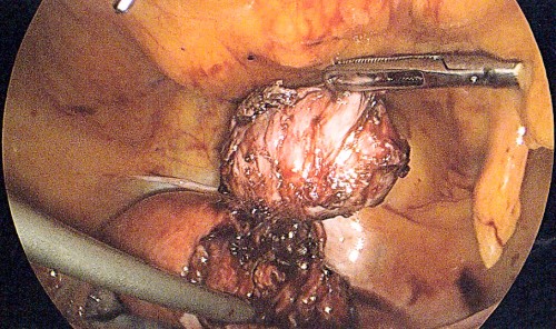 Figure_2 (6)