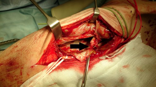 Figure_3