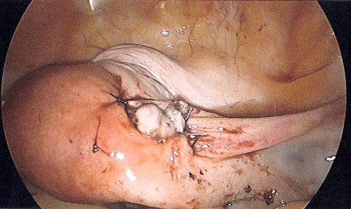 Figure_4 (3)