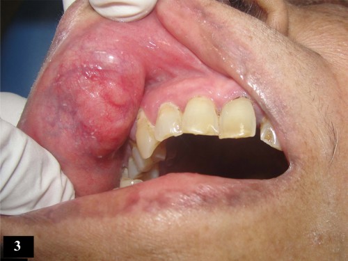 Fig_3 (4)