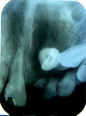 figure_2-IOPA_view
