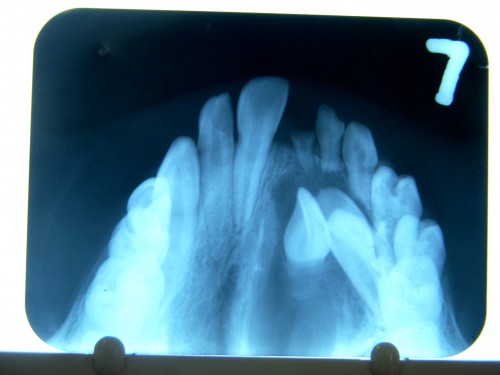 figure_3-Occlusal_view
