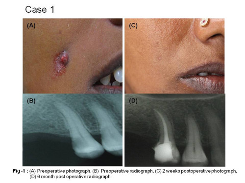 CASE-1
