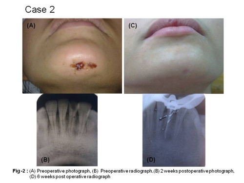 CASE-2