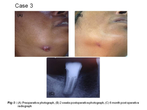 CASE-3