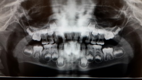Figure_1 (28)