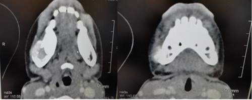 Figure_4 (4)