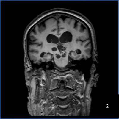Image2