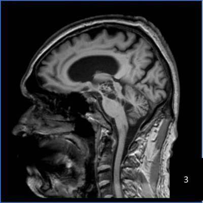Image3