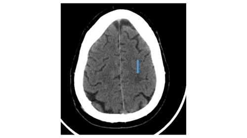 fig_1 (8)