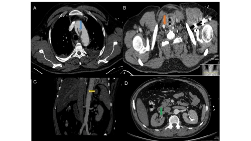 fig_3 (6)