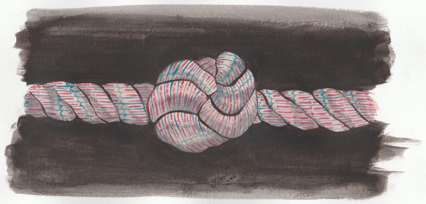 Metaphorical muscle knot.